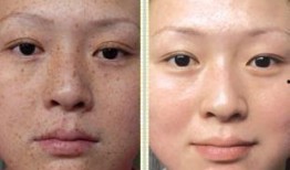 徒手祛斑爆料视频教程图片,跟随视频教程轻松告别斑点困扰